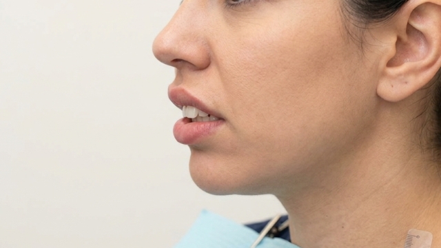 無理やり並べると「出っ歯」になる可能性あり