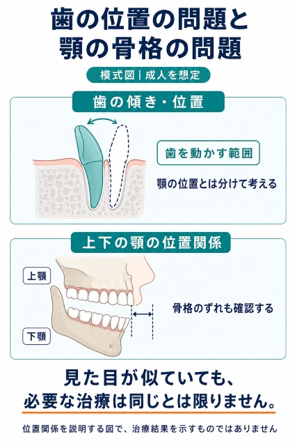 歯の位置の問題と顎の骨格の問題