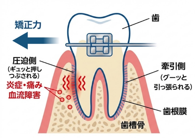 痛みの科学的メカニズム