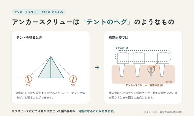 アンカースクリューはテントのペグのようなもの