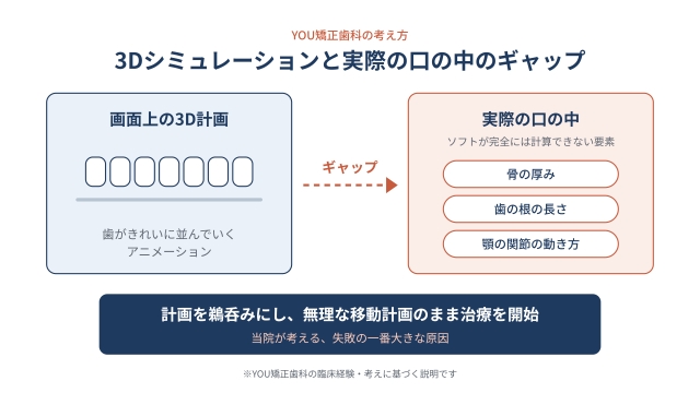 3Dシミュレーションと実際の口の中のギャップ