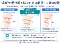 口元の図解