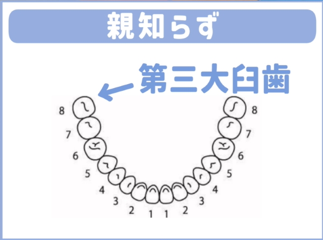 親知らずの基礎知識:なぜトラブルメーカーなのか?