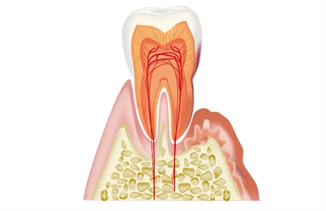 「歯周病」リスクの劇的な低減